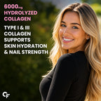Hydrolyzed Collagen Peptides 6000mg Tablets | Type I & III Collagen for Skin, Hair, Nails & Joint Support | High Bioavailability | 180 Tablets for Men & Women